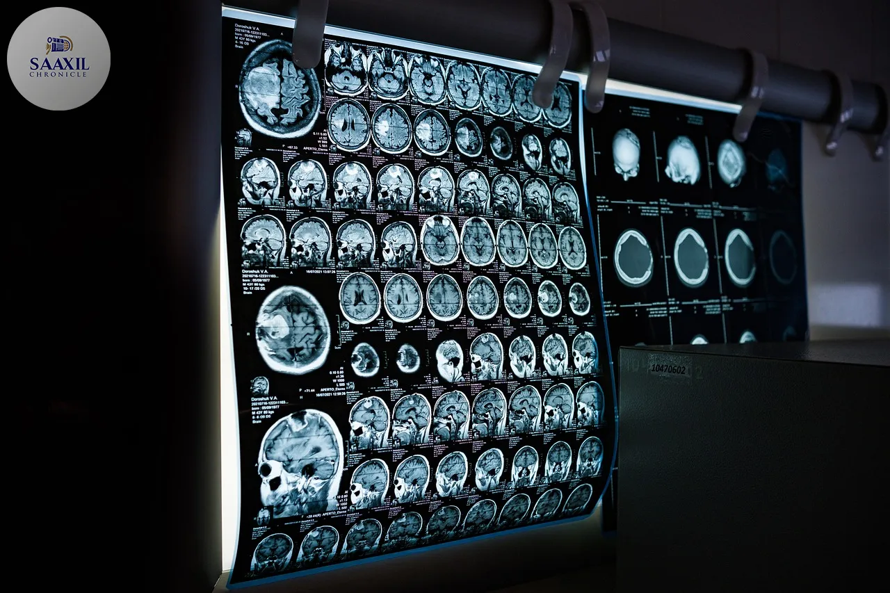Dual Brain Scans Offer Early Clues to Future Teen Anxiety, Report Suggests